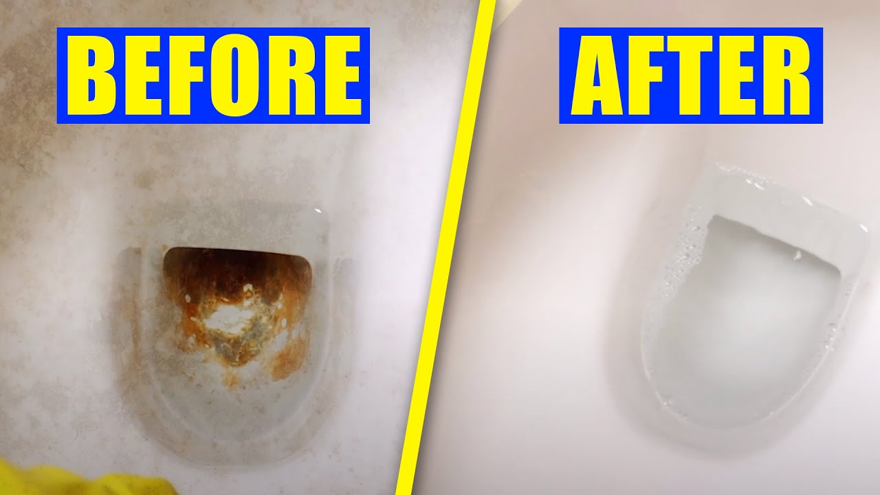 How to Get Rid of Brown Stains in Toilet Bowl